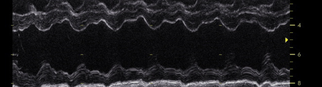 ID982 - Didactisch parcours echocardiografie bij kleine huisdieren - editie 7